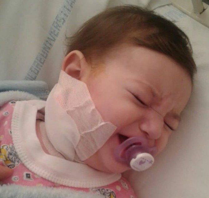 Apel për të gjithë shqiptarët, vogëlushja dyvjeçare vuan nga një sëmundje e rëndë