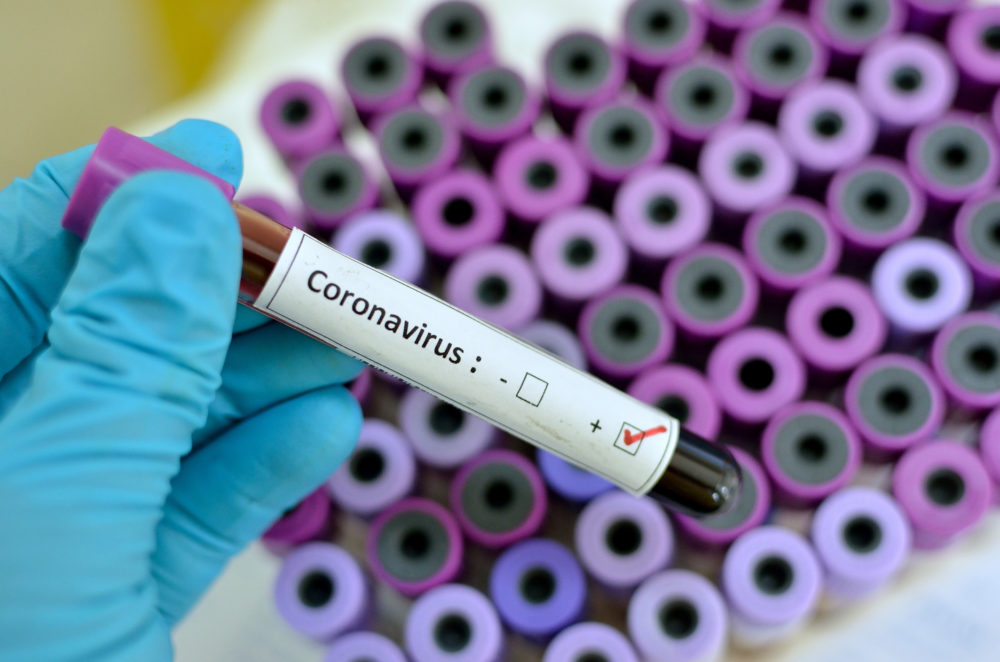 Koronavirusi në Shqipëri, tre viktima dhe 69 raste të reja