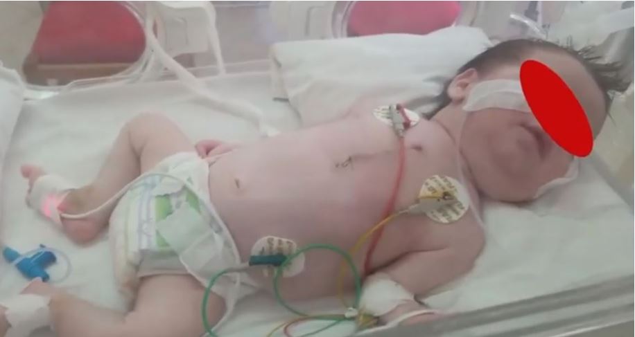 Ndodh mrekullia / Operacioni i vështirë i shpëton jetën foshnjes 12 ditëshe